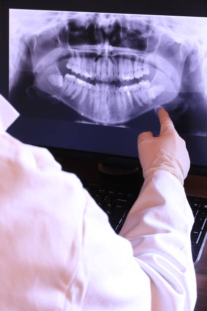 Best Emergency Wisdom Tooth Extraction in Poth, TX